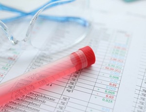 Prazo do exame toxicológico é alterado: confira as novas regras do CTB
